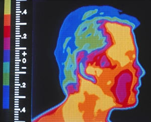 Thermogram of head Thermogram of head