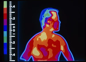Thermogram of man Thermogram of man