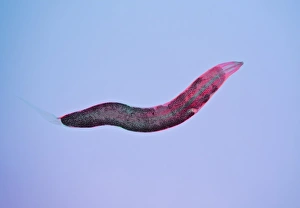 Intestinal Parasites Prints: Threadworm, light micrograph