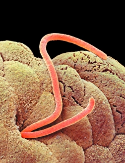 Scanning Electron Micrograph SEM Images Prints: Threadworms in the gut, SEM