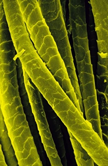 Tinted SEM of Shetland wool from knitted pullover Tinted SEM of Shetland wool from knitted pullover