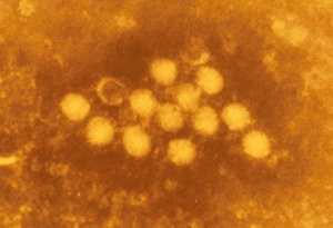 Tinted TEM of coxsackievirus particles Tinted TEM of coxsackievirus particles