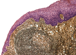 Light Microscopy Images Prints: Tonsil, light micrograph F006 / 9818
