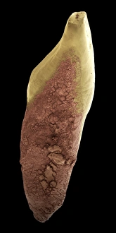Prints of Tooth decay. Coloured scanning electron micrograph (SEM) of dental plaque (brown) on a human incisor. Plaque is a film of bacteria embedded in a glycoprotein matrix Images Dated 2006 May: SEM Print of Tooth Decay on Human Incisor