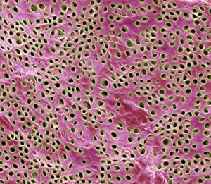 Prints of Tooth dentine. Coloured scanning electron micrograph (SEM) of dentine from a milk tooth. The bulk of a tooth is formed of dentine, a mineralised connective tissue with a similar composition to bone Images Dated 2007 April: Coloured SEM Print of Tooth Dentine