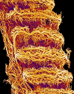 Trachea Trachea
