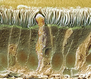Trachea Lining SEM Prints: Trachea lining, SEM C013 / 7123