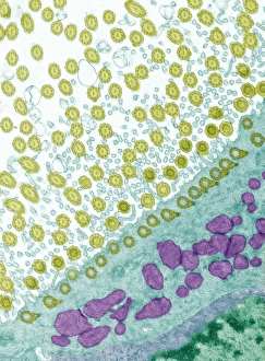 Transmission Electron Microscopy Images Prints: Trachea lining, TEM C014 / 1472