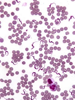 Trypanosomes in blood smear, SEM C016/5783 Trypanosomes in blood smear, SEM C016/5783