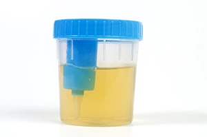 Urine Sample Print in a Cup