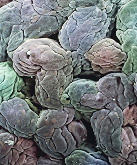 Uterine lining, SEM Uterine lining, SEM