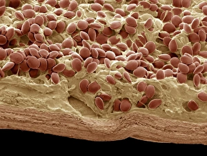 Prints of Vanilla pod, coloured scanning electron micrograph (SEM). Section through a vanilla pod showing the seeds (orange) and parachyma tissue Images Dated 2009 May: Print of Vanilla Pod, SEM