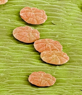 Prints of Venus flytrap digestive glands. Coloured scanning electron micrograph (SEM) of digestive glands from a Venus flytrap plant (Dionaea muscipula) Images Dated 2003 August: SEM Print of Venus flytrap digestive glands