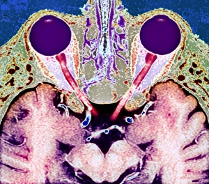 Human Eye Anatomy Prints: Vision and the brain, MRI scan