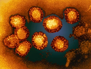 West Nile viruses West Nile viruses