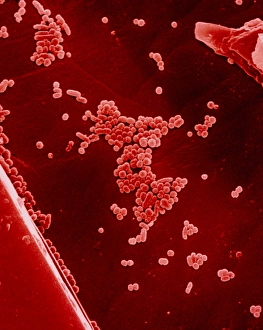 Wine yeast cells, Saccharomyces Wine yeast cells, Saccharomyces