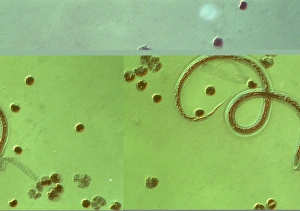 Wuchereria bancrofti parasite Wuchereria bancrofti parasite