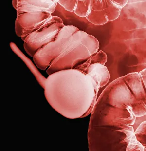 Images Dated 2012 April: Colour X-ray Print of Healthy Appendix and Colon