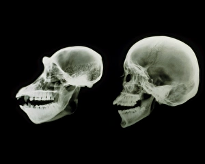 X-ray of human and chimpanzee skulls X-ray of human and chimpanzee skulls