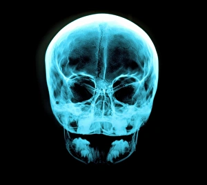 Anatomy Of The Human Head Prints: X-ray of human skull