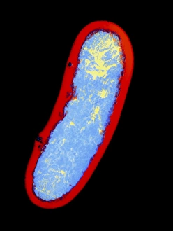 Yersinia pestis bacterium Yersinia pestis bacterium