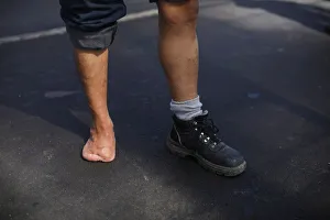 A civil war veteran shows his injuries during a protest during the commemoration of the A civil war veteran shows his injuries during a protest during the commemoration of the