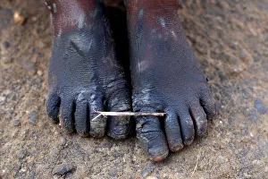A Rohingya refugee boys feet are covered with mud after crossing the Bangladesh-Myanmar A Rohingya refugee boys feet are covered with mud after crossing the Bangladesh-Myanmar