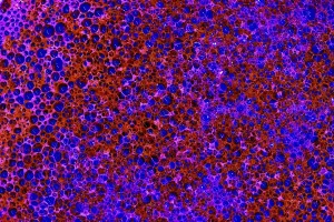 Foamy Texture Print