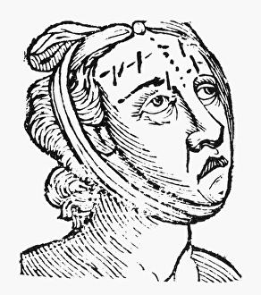 PHYSIOGNOMY, 1648. Forehead of a vicious woman. Woodcut from Philippus Phinellas PHYSIOGNOMY, 1648. Forehead of a vicious woman. Woodcut from Philippus Phinellas