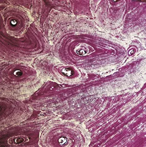 Bones, Osseous tissue of femur, extreme close-up Bones, Osseous tissue of femur, extreme close-up