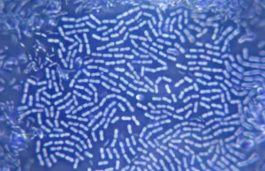 Science Prints: Bacteria Colony Microscope Print