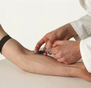 Blood Test Procedure Prints: Hypodermic needle inserted into forearm