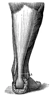 Antique medical scientific illustration high-resolution: Achilles heel Antique medical scientific illustration high-resolution: Achilles heel