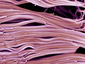 Collagen, Scanning electron micrograph (SEM) Collagen, Scanning electron micrograph (SEM)