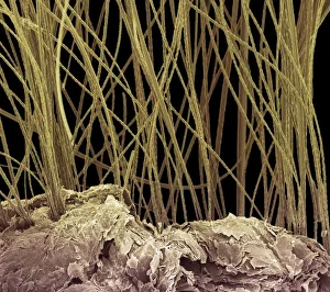 Dog hair, colored scanning electron micrograph (SEM) Dog hair, colored scanning electron micrograph (SEM)