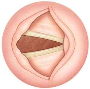 Illustration of open human vocal fold to inhale air, also known as vocal cords Illustration of open human vocal fold to inhale air, also known as vocal cords