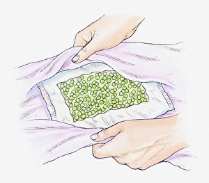 Illustration of a pack of frozen peas being wrapped in a towel to use as a cold compress Illustration of a pack of frozen peas being wrapped in a towel to use as a cold compress
