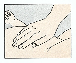 Illustration showing physical examination of babys abdomen to check for organ enlargement Illustration showing physical examination of babys abdomen to check for organ enlargement