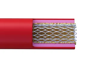 Illustration of stent placed in an artery Illustration of stent placed in an artery