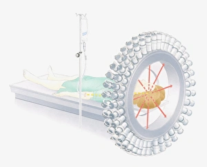 Illustration of using radioactive isotopes (radionuclides) for medical imaging Illustration of using radioactive isotopes (radionuclides) for medical imaging