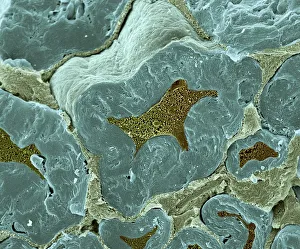 Nerve fibers, scanning electron micrograph Nerve fibers, scanning electron micrograph