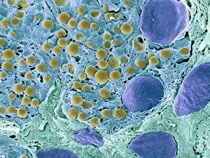 Pancreas tissue, colored scanning electron micrograph Pancreas tissue, colored scanning electron micrograph