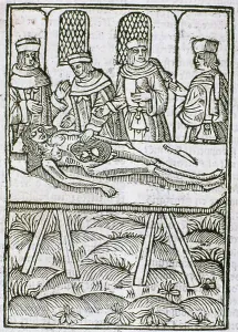 A Dissection in Progress: 15th Century Woodcut Print