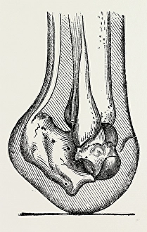 anatomy , medical equipment, surgical instrument, history of medicine anatomy , medical equipment, surgical instrument, history of medicine
