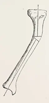 Antique Surgical Instruments Prints: A B C