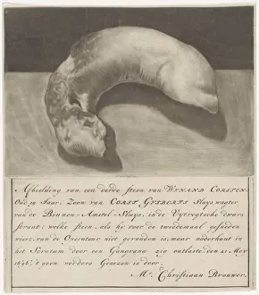 Engraved Medical Illustrations Prints: Bladder stone Wynand Corsten Image bladder stone