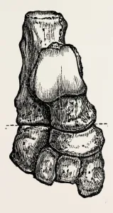 bones, medical equipment, surgical instrument, history of medicine bones, medical equipment, surgical instrument, history of medicine
