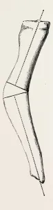 cunei, medical equipment, surgical instrument, history of medicine cunei, medical equipment, surgical instrument, history of medicine