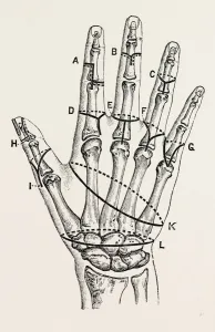 disarticulation by single external, medical equipment, surgical instrument, history disarticulation by single external, medical equipment, surgical instrument, history