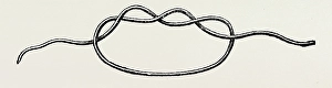 first stage of the surgeons knot, medical equipment, surgical instrument, history first stage of the surgeons knot, medical equipment, surgical instrument, history